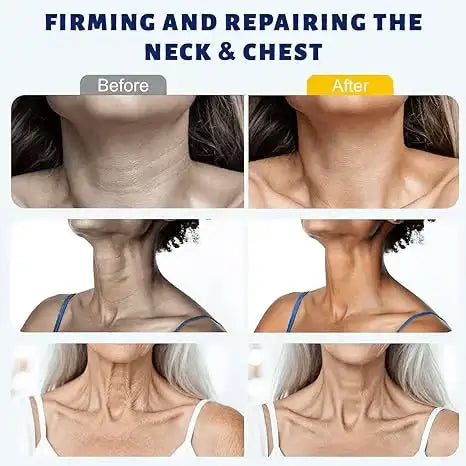 Buy 1 Get 1 Free Alisanda™ Instant Neck Lift Cream – Firm, Smooth & Tighten the Look of Neck Skin