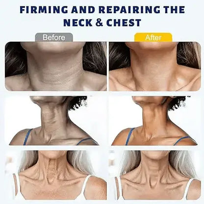 Buy 1 Get 1 Free Alisanda™ Instant Neck Lift Cream – Firm, Smooth & Tighten the Look of Neck Skin