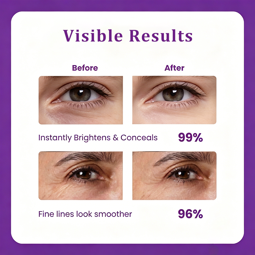 🔥LAST DAY 60% OFF!!GEZRIA™Korean Calcium Dark Spot Eye Cream