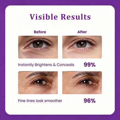 🔥LAST DAY 60% OFF!!GEZRIA™Korean Calcium Dark Spot Eye Cream
