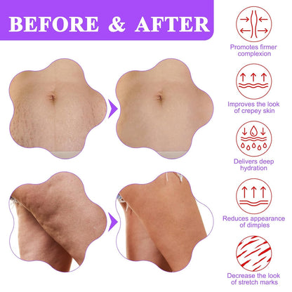 ✨ 26,000+ Moms Love It — GEZRIA Tighten & Smooth Belly Cream | Visibly Firmer, Smoother Skin in Just 7 Days 💜