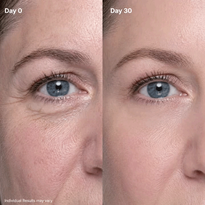 🔥Final 2 Hour 50% OFF🔥 AQA  Eye Renewal Cream
